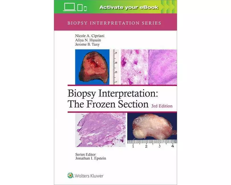 Biopsy Interpretation: The Frozen Section: Print + eBook with Multimedia