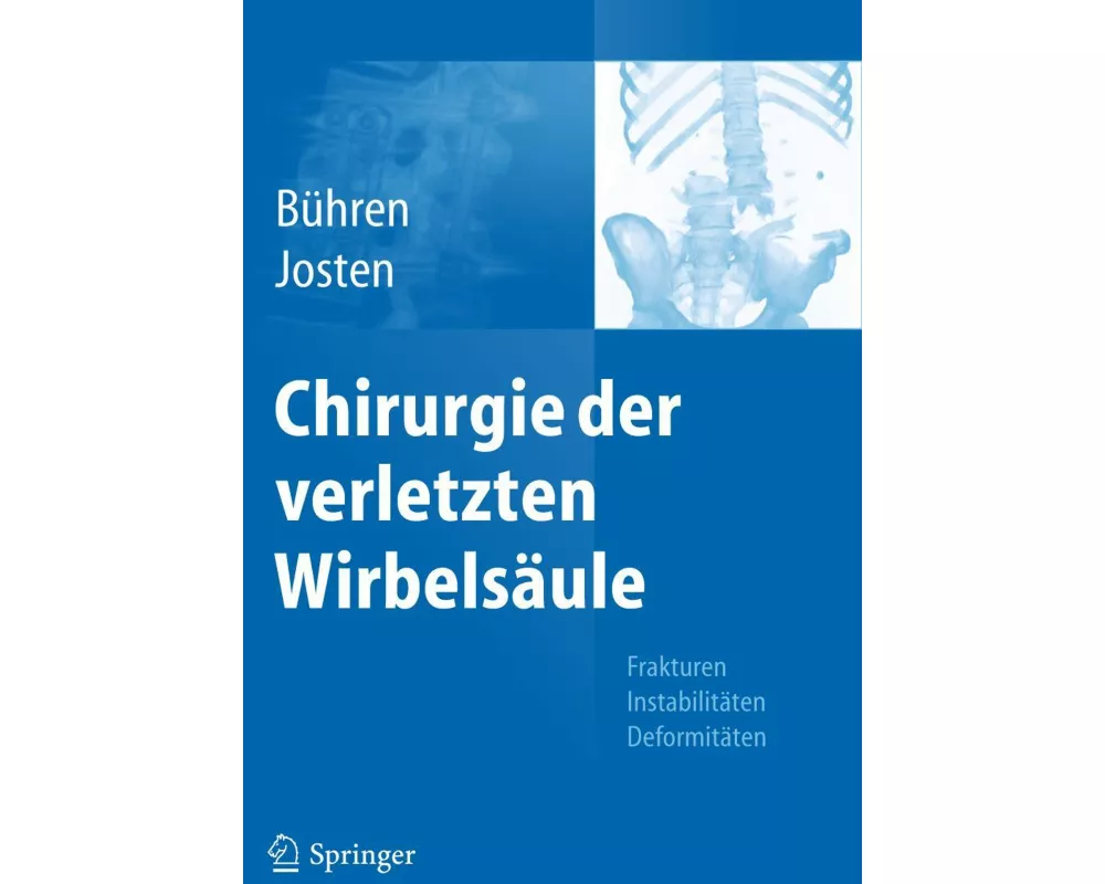 Chirurgie der verletzten Wirbelsäule