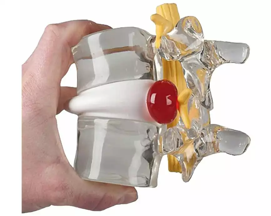 Rüdiger Skelett Bandscheibenvorfall Simulator