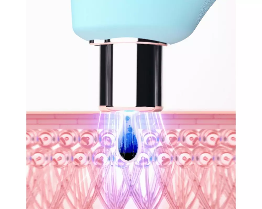 Foreo KIWI Vakuum Porenreiniger mit Blaulichttherapie
