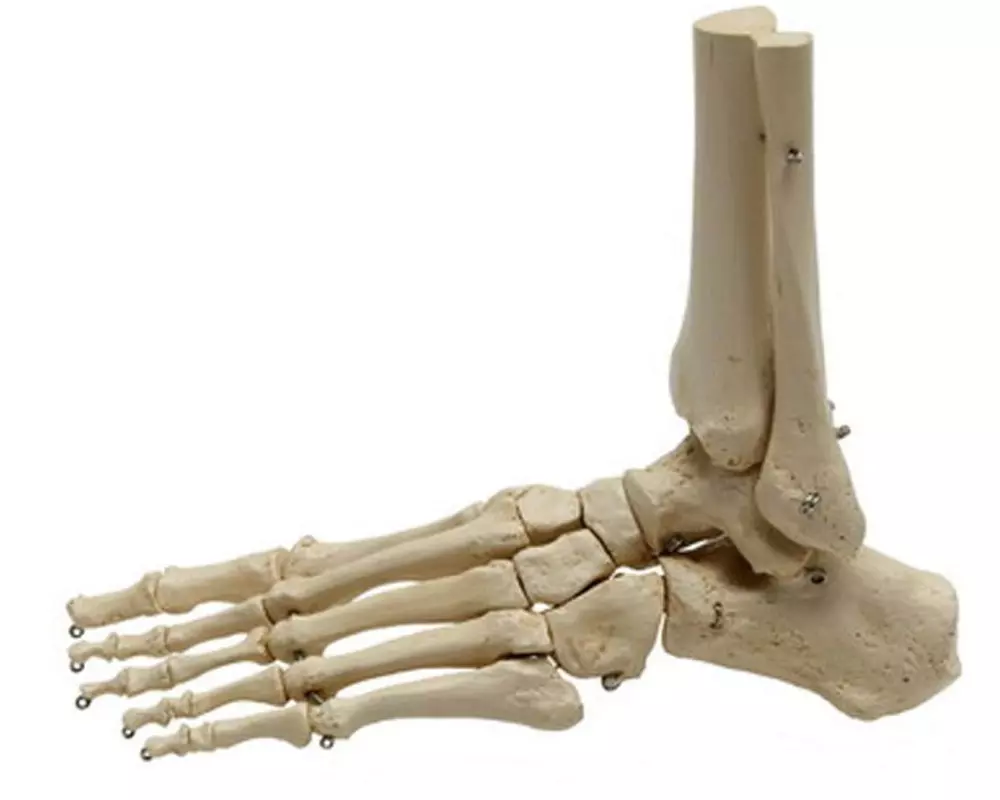 Rüdiger Skelett Fuss mit Unterschenkelstumpf