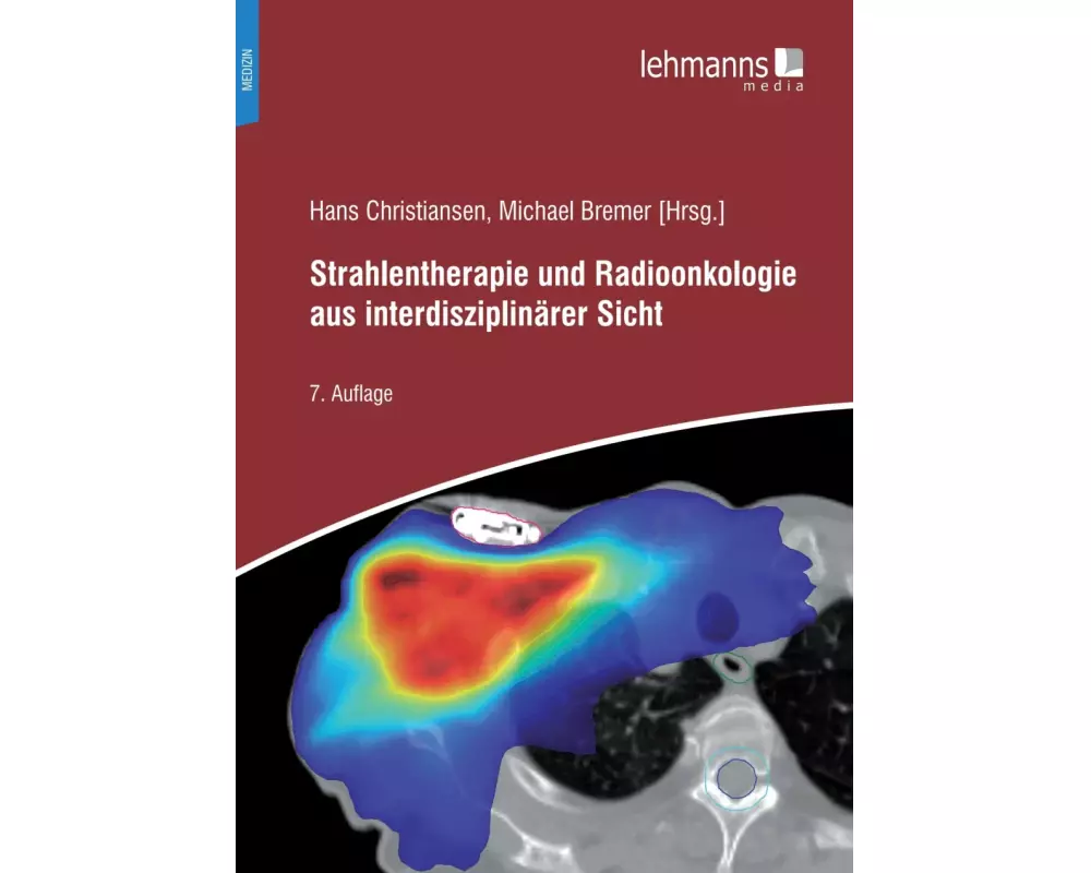 Strahlentherapie und Radioonkologie aus interdisziplinärer Sicht