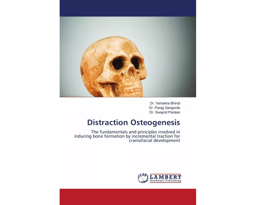 Distraction Osteogenesis