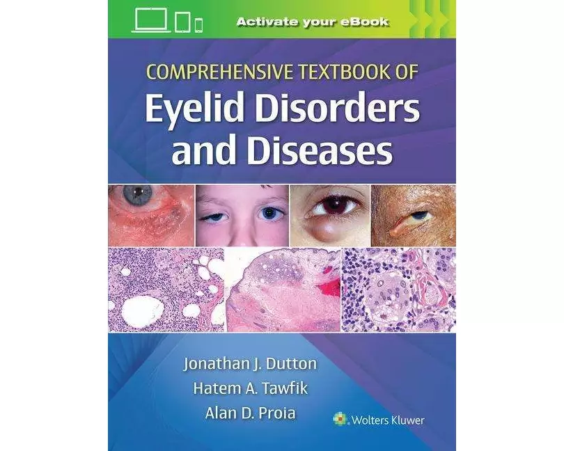 Comprehensive Textbook of Eyelid Disorders and Diseases