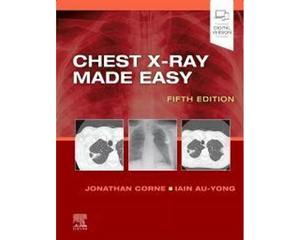 Chest X-Ray Made Easy