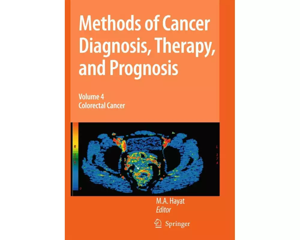 Methods of Cancer Diagnosis, Therapy and Prognosis