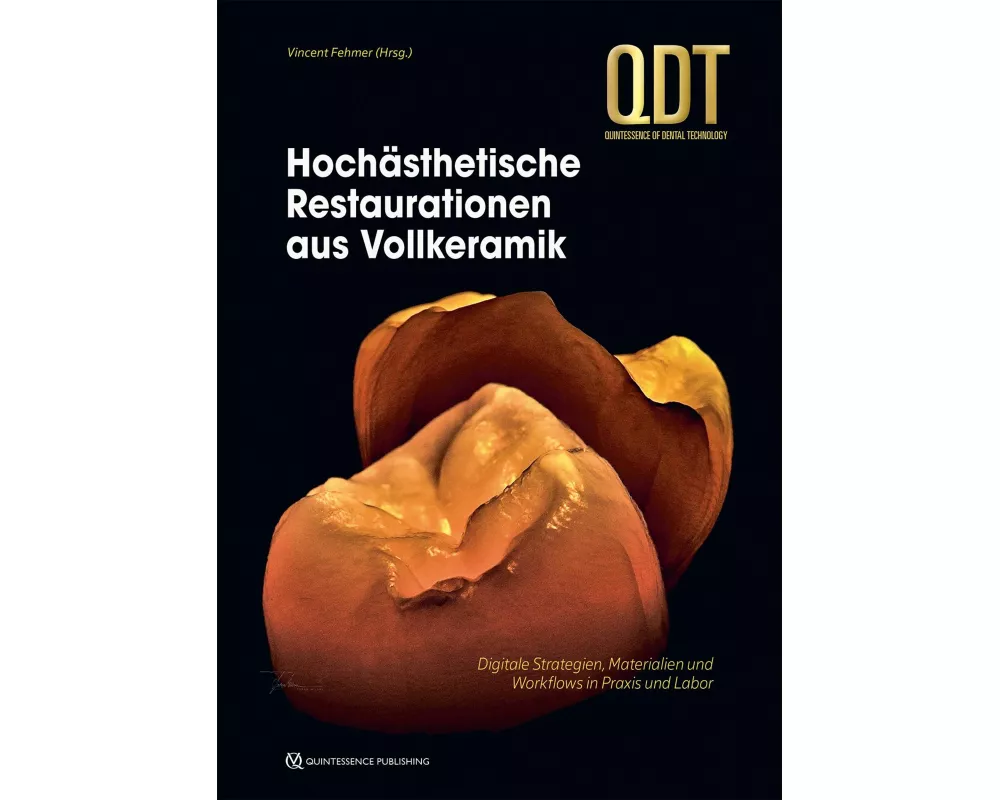 Hochästhetische Restaurationen aus Vollkeramik