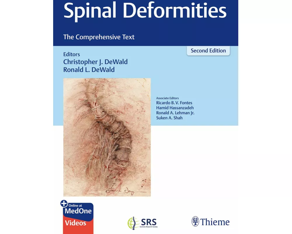 Spinal Deformities
