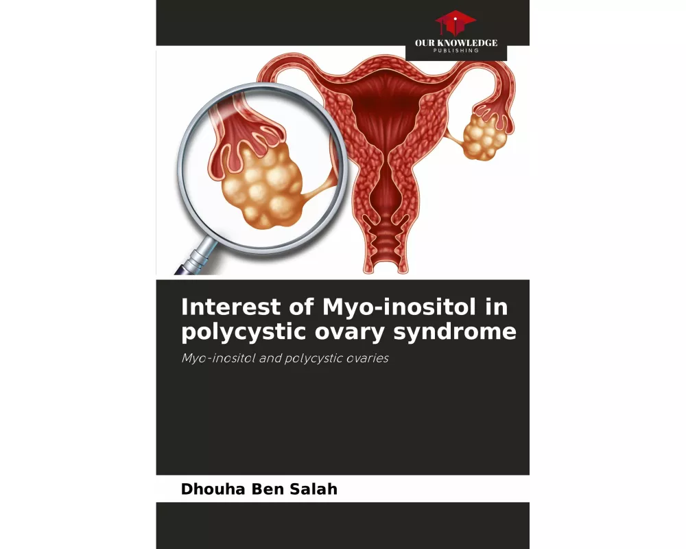 Interest of Myo-inositol in polycystic ovary syndrome