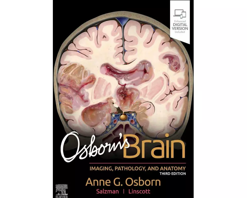 Osborn's Brain
