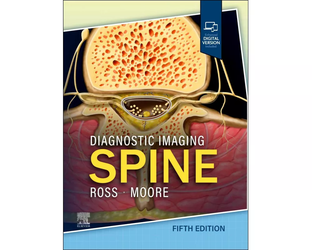 Diagnostic Imaging: Spine