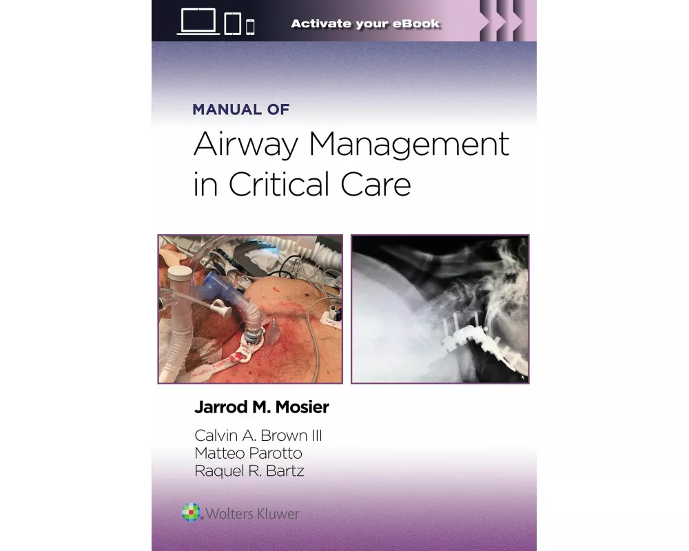 Manual of Airway Management in Critical Care: Print + eBook with Multimedia