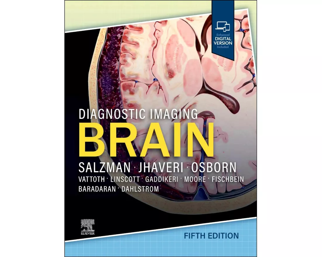 Diagnostic Imaging: Brain