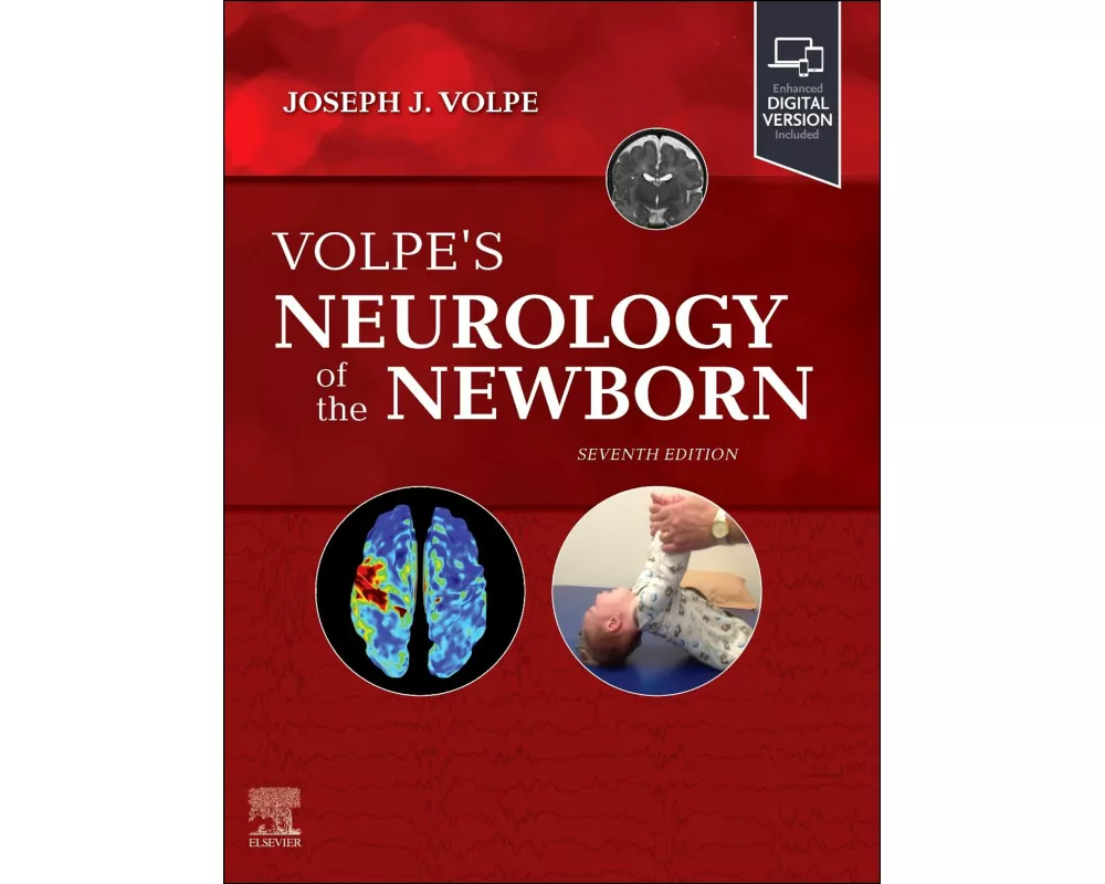 Volpe's Neurology of the Newborn