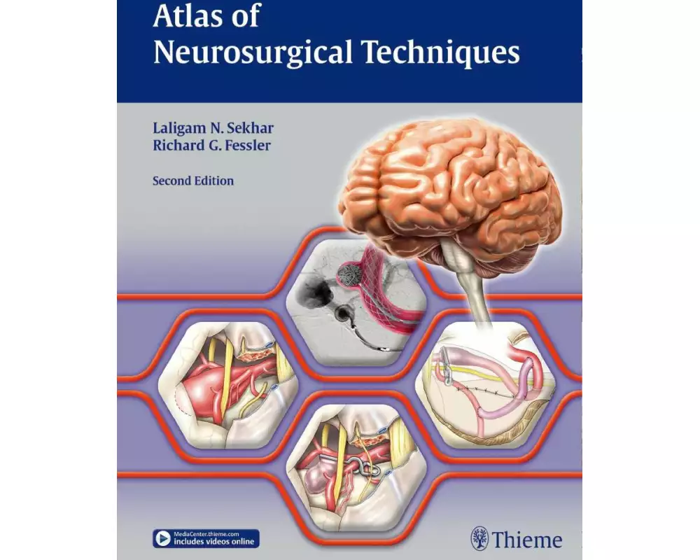 Atlas of Neurosurgical Techniques. Brain
