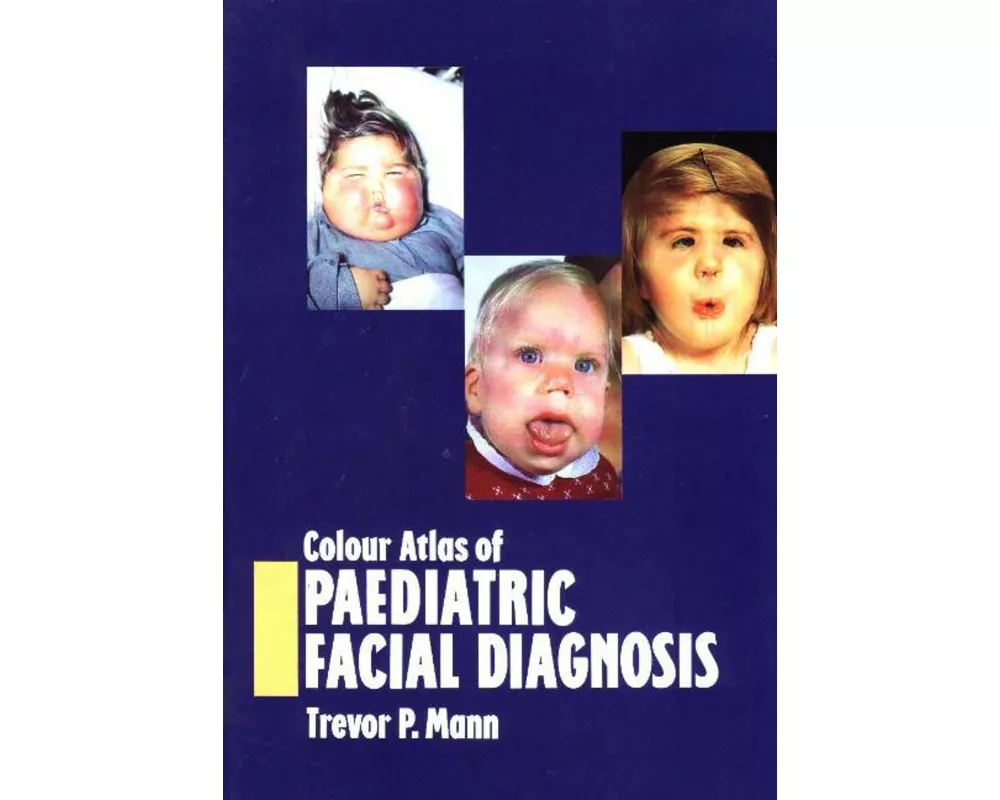 Colour Atlas of Paediatric Facial Diagnosis