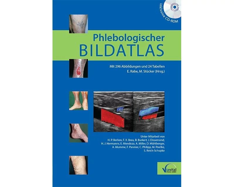 Phlebologischer Bildatlas