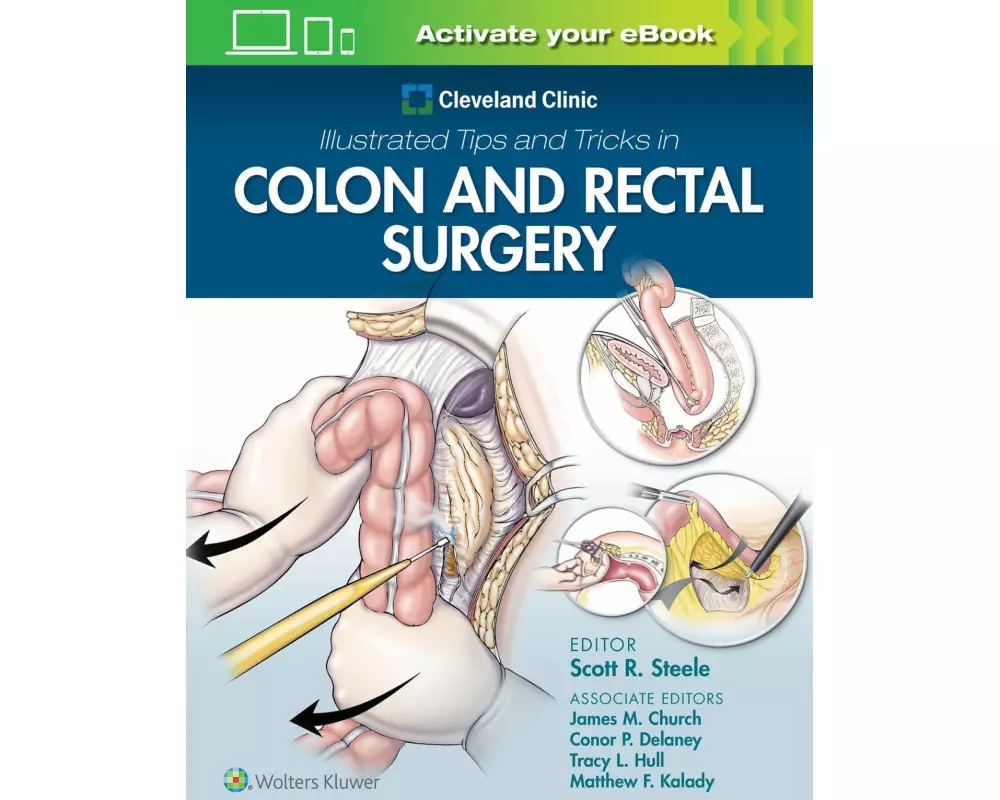 Cleveland Clinic Illustrated Tips and Tricks in Colon and Rectal Surgery