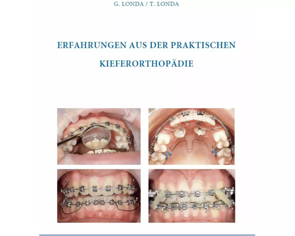 Erfahrungen aus der praktischen Kieferorthopädie