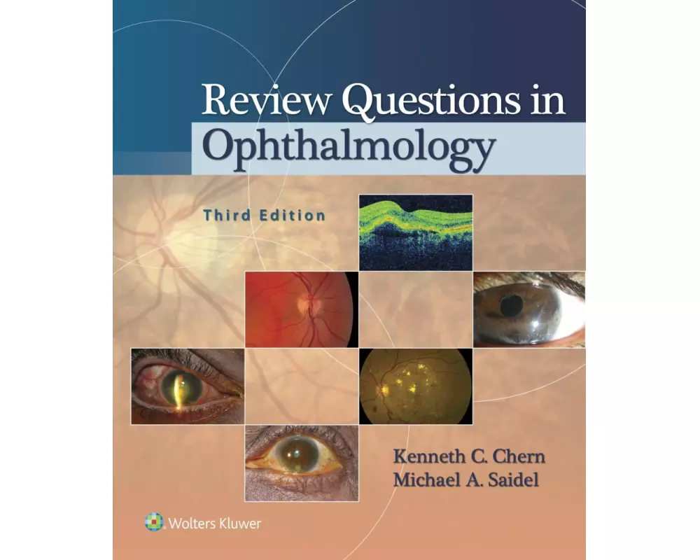 Review Questions in Ophthalmology