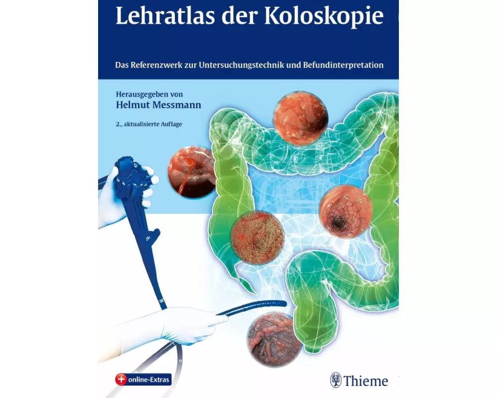 Lehratlas der Koloskopie