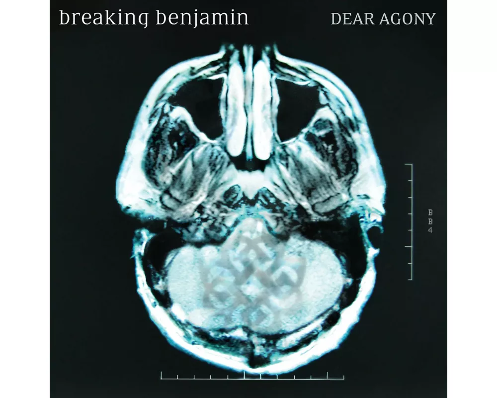 Dear Agony