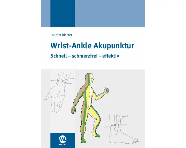 Wrist-Ankle Akupunktur