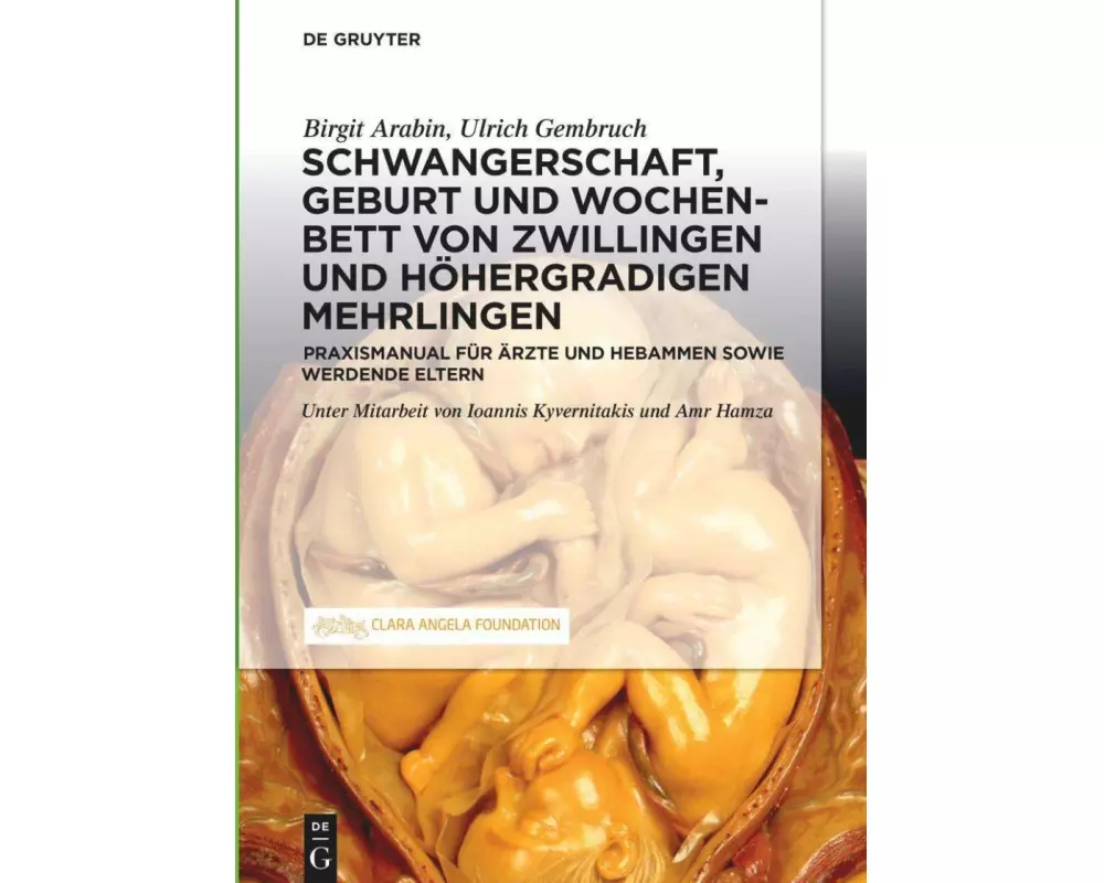 Schwangerschaft, Geburt und Wochenbett von Zwillingen und höhergradigen Mehrlingen