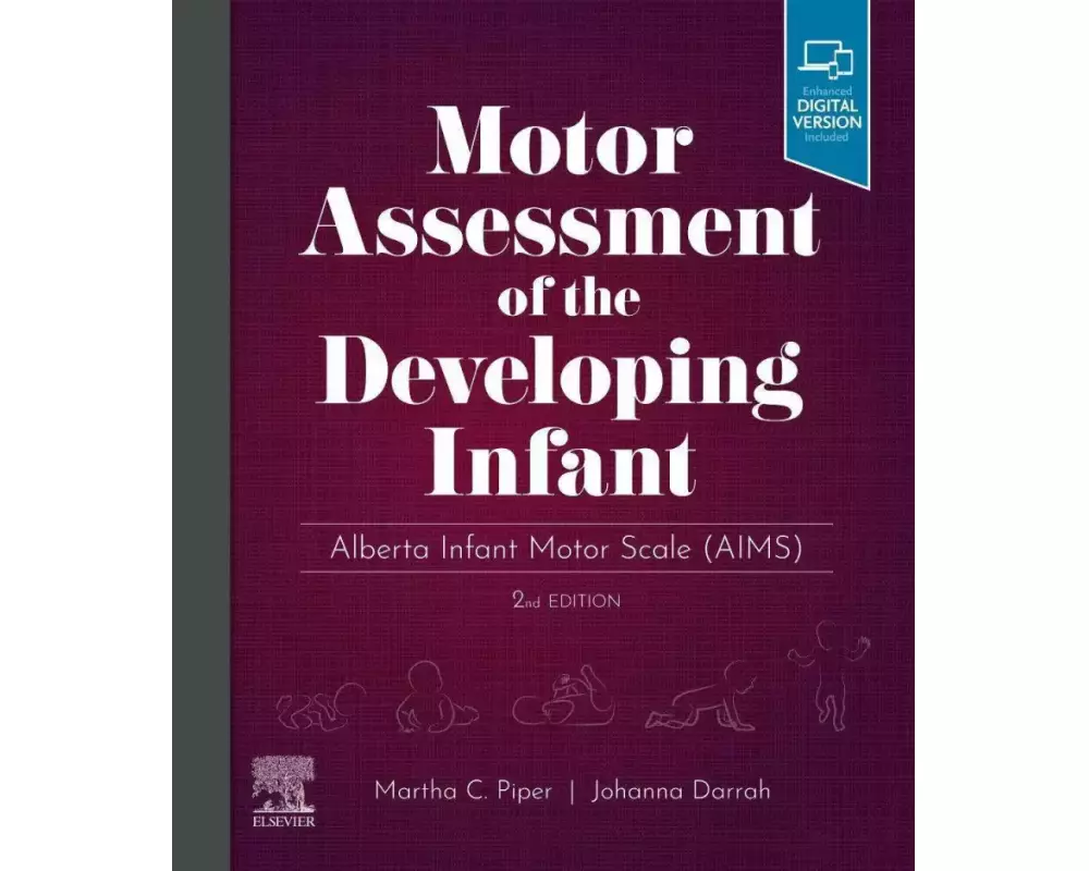 Motor Assessment of the Developing Infant