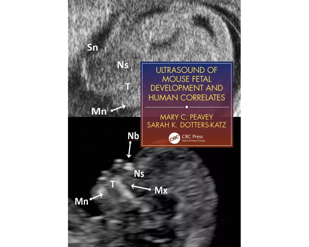 Ultrasound of Mouse Fetal Development and Human Correlates