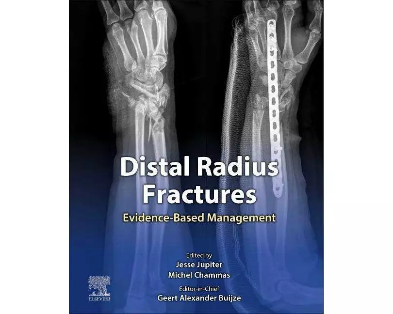 Distal Radius Fractures