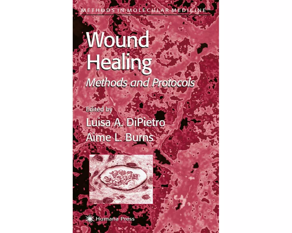 Wound Healing