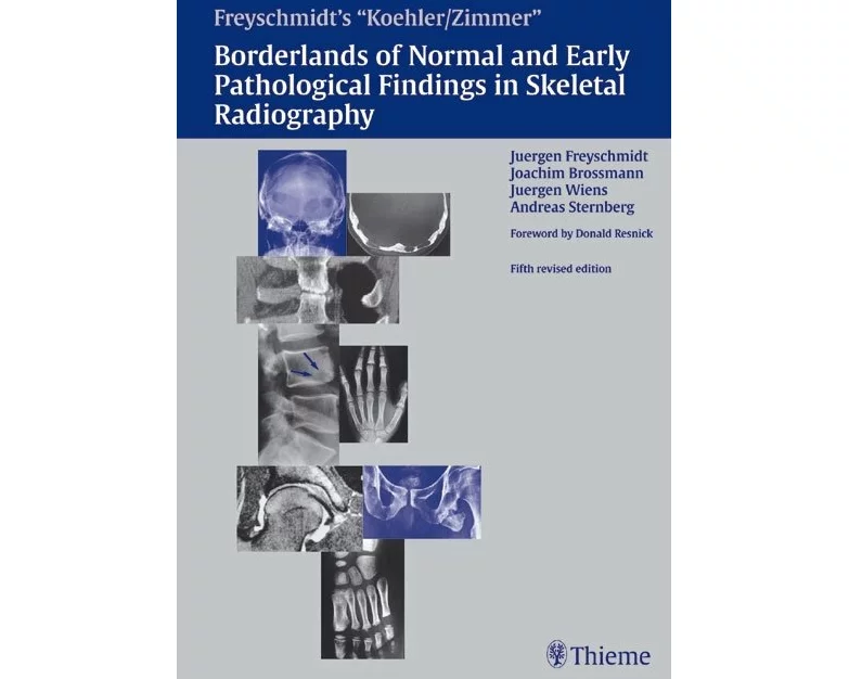 Borderlands of Normal and Early Pathologic Findings in Skeletal Radiograph