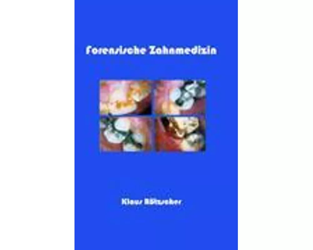 Forensische Zahnmedizin