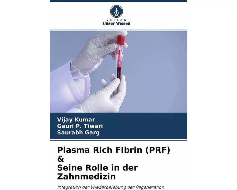 Plasma Rich FIbrin (PRF) & Seine Rolle in der Zahnmedizin