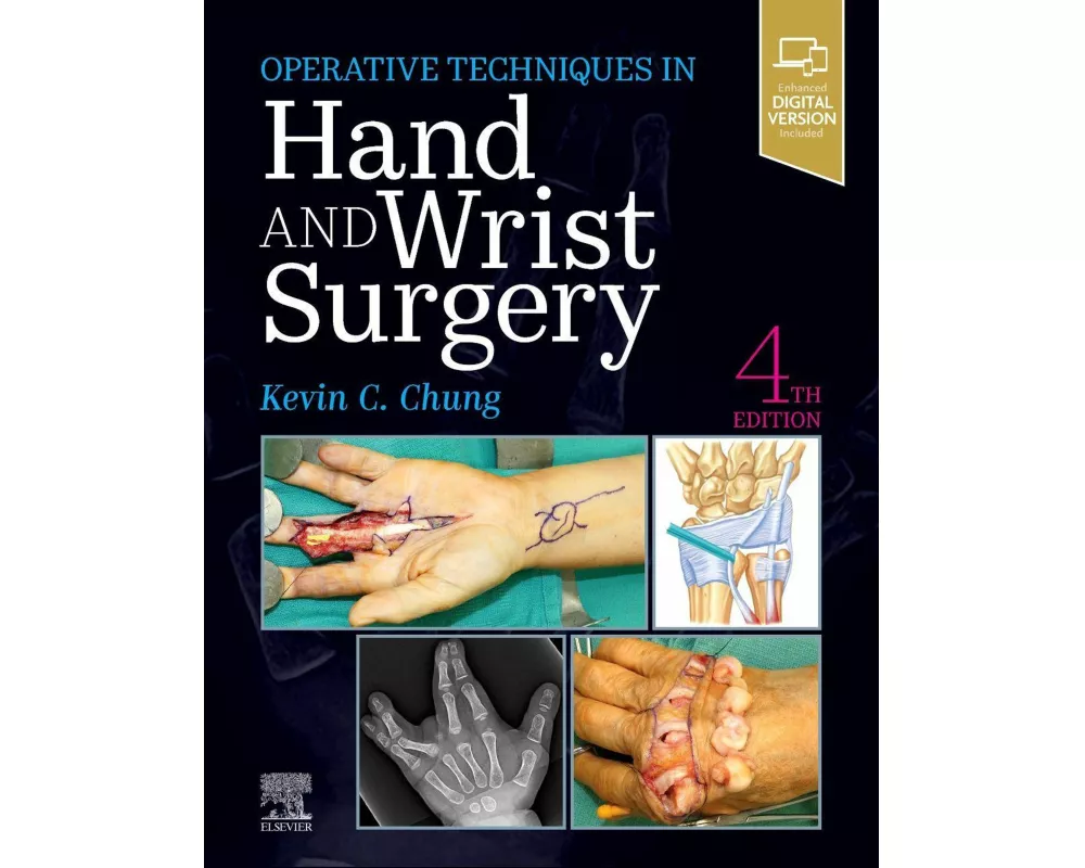 Operative Techniques: Hand and Wrist Surgery