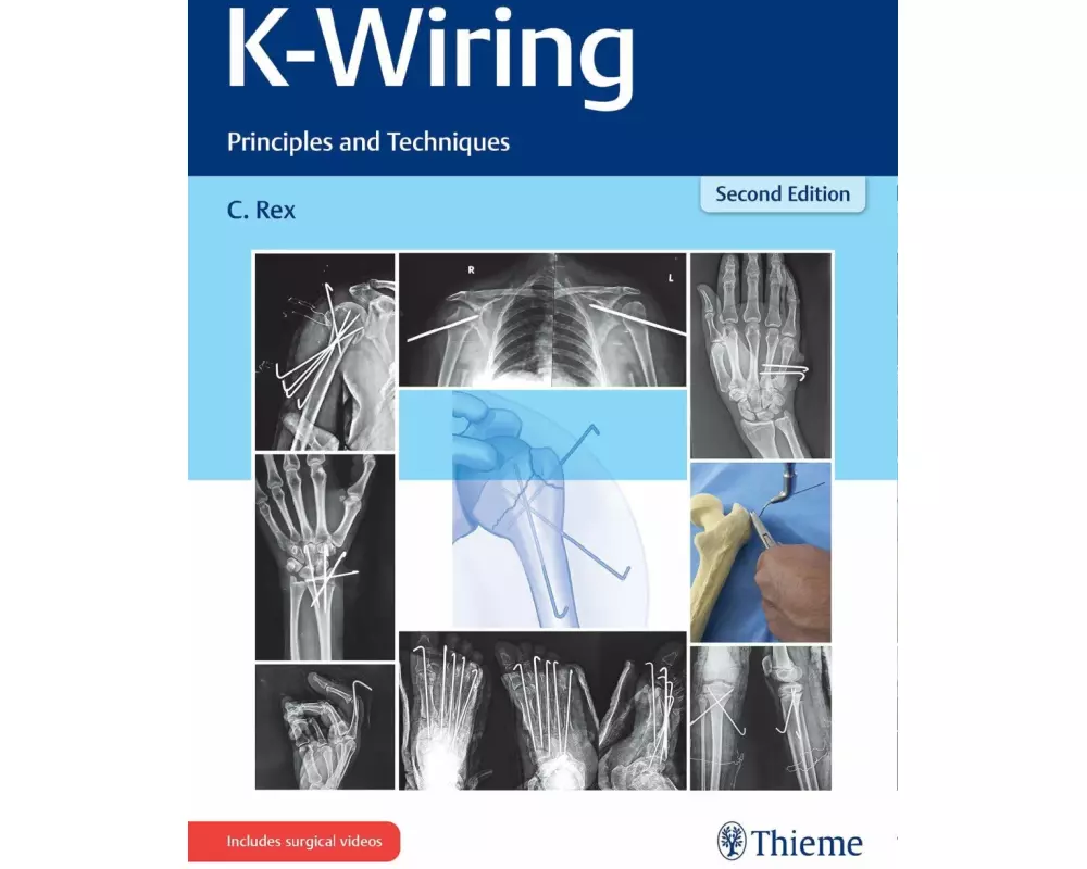 K-Wiring