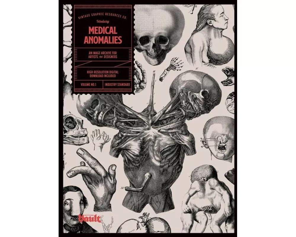 Medical Anomalies