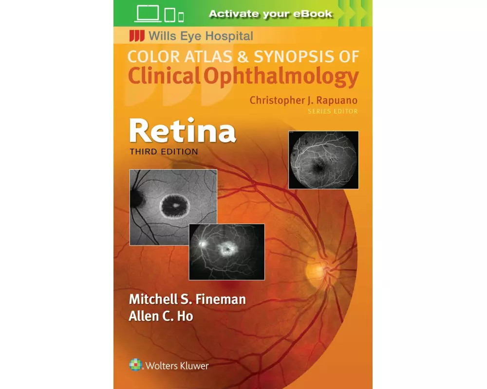 Retina (Color Atlas and Synopsis of Clinical Ophthalmology)