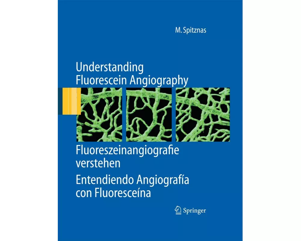 Understanding Fluorescein Angiography, Fluoreszeinangiografie verstehen, Entendiendo Angiografía con Fluoresceína
