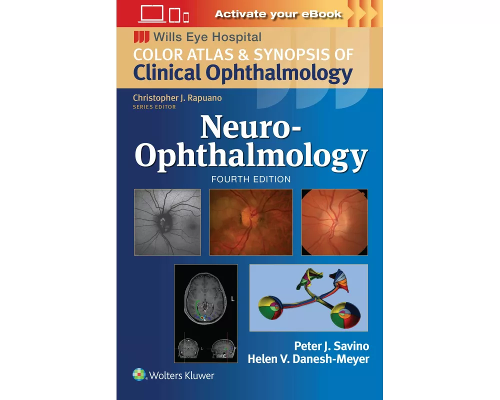 Neuro-Ophthalmology: Print + eBook with Multimedia