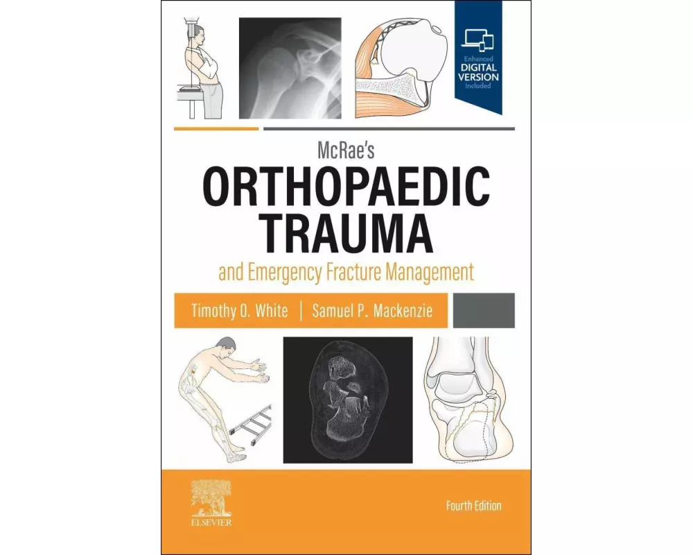 McRae's Orthopaedic Trauma and Emergency Fracture Management