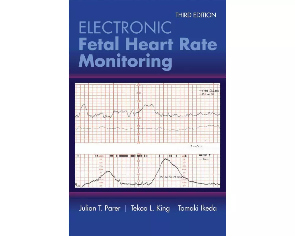 Electronic Fetal Heart Rate Monitoring: The 5-Tier System