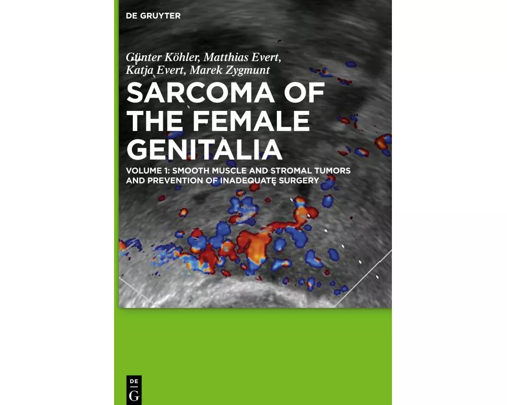 Smooth muscle and stromal tumors and prevention of inadequate surgery