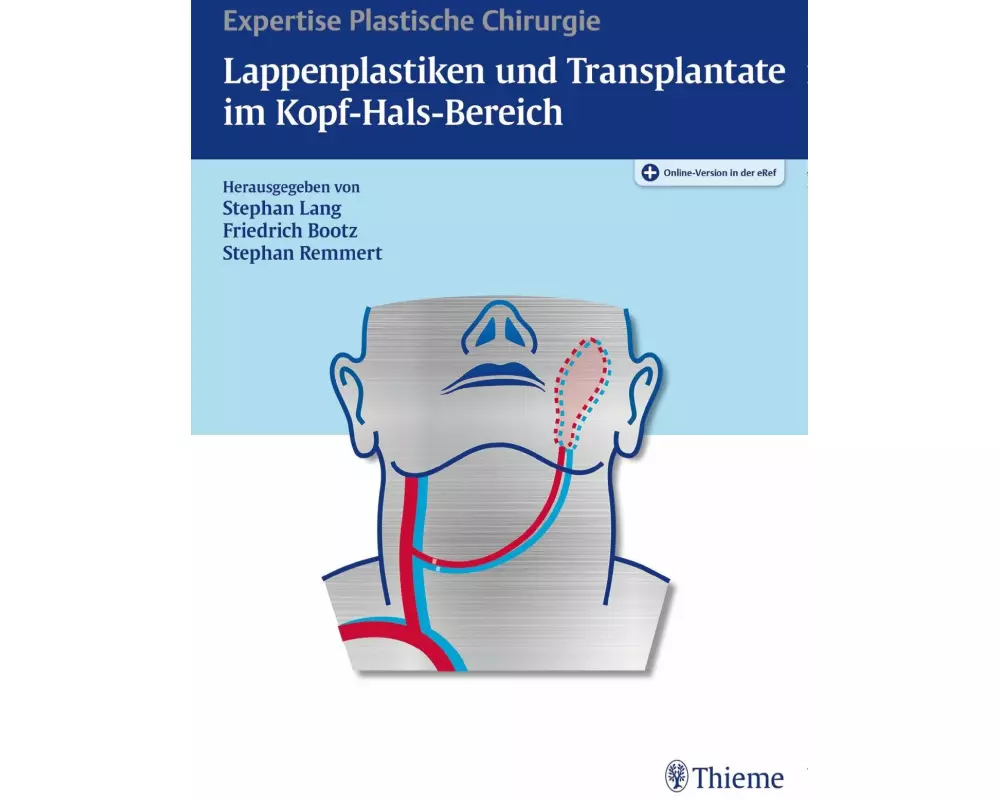 Lappenplastiken und Transplantate im Kopf-Hals-Bereich