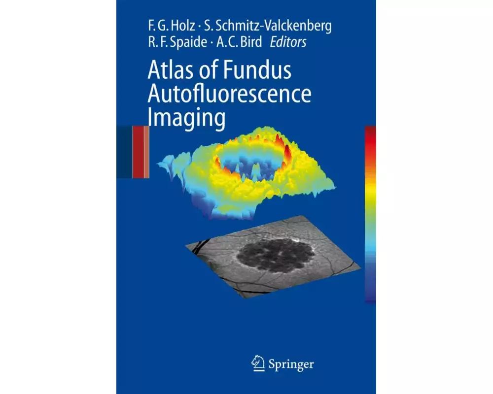 Atlas of Fundus Autofluorescence Imaging