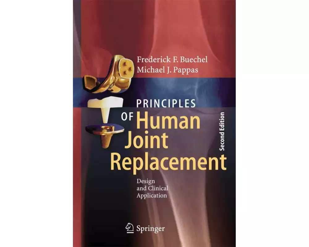 Principles of Human Joint Replacement