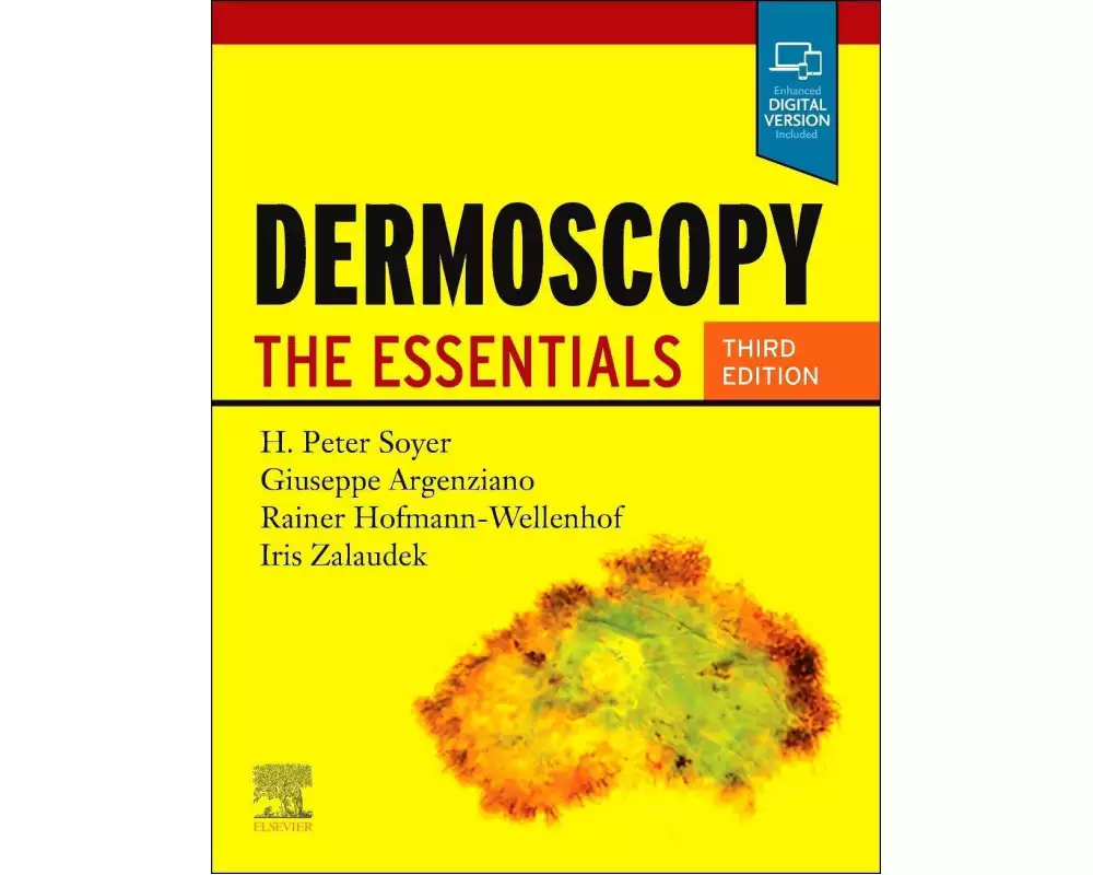 Dermoscopy