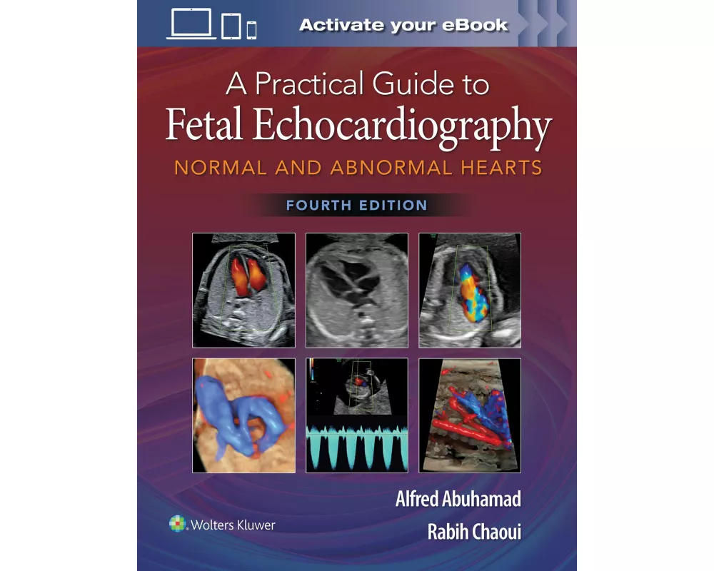 A Practical Guide to Fetal Echocardiography