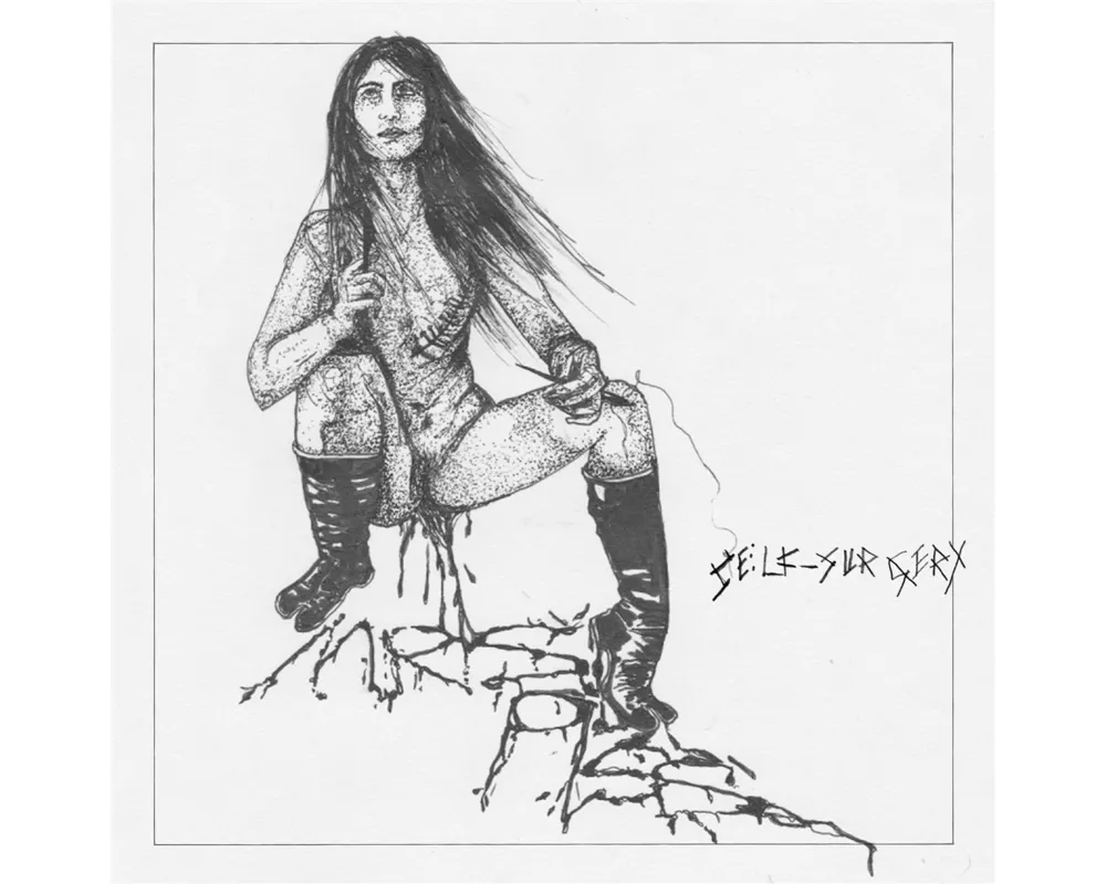 Self-Surgery